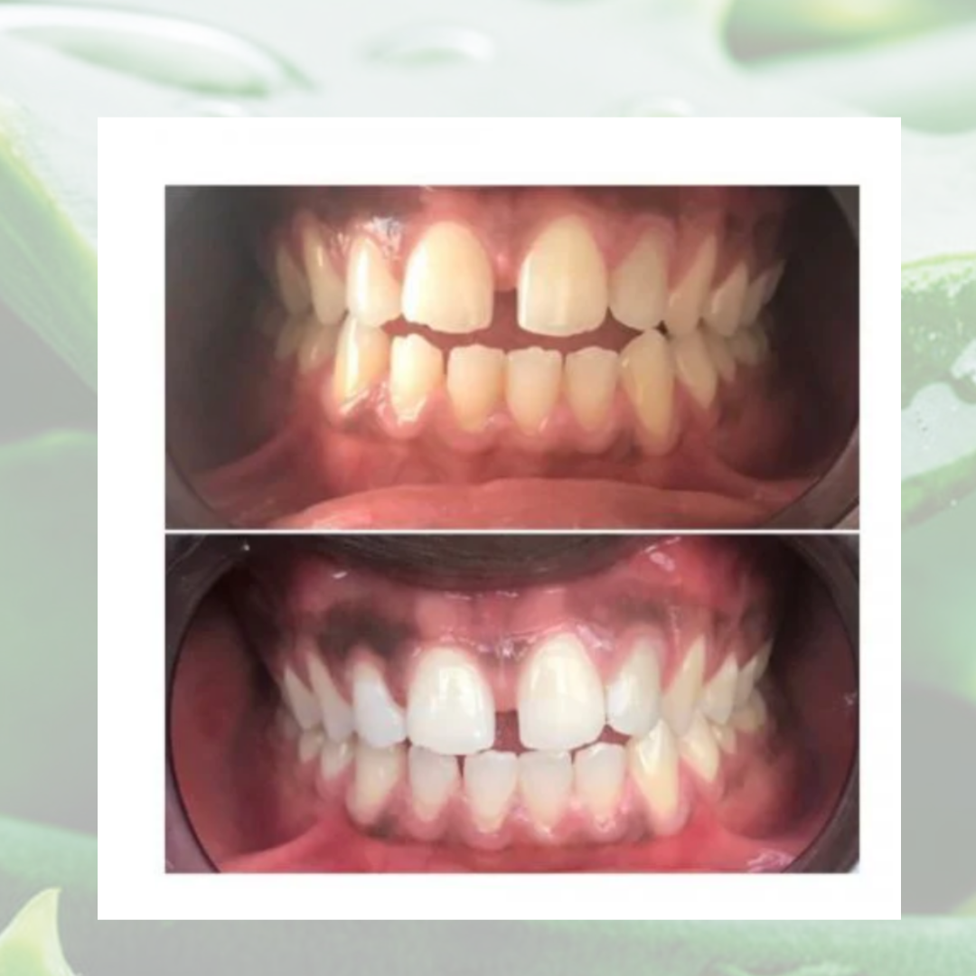 Dentifrice blanchissant à l'Aloe vera
