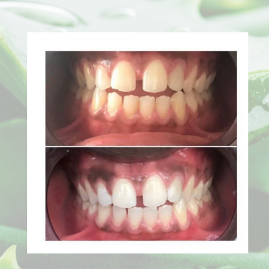 Dentifrice blanchissant à l'Aloe vera